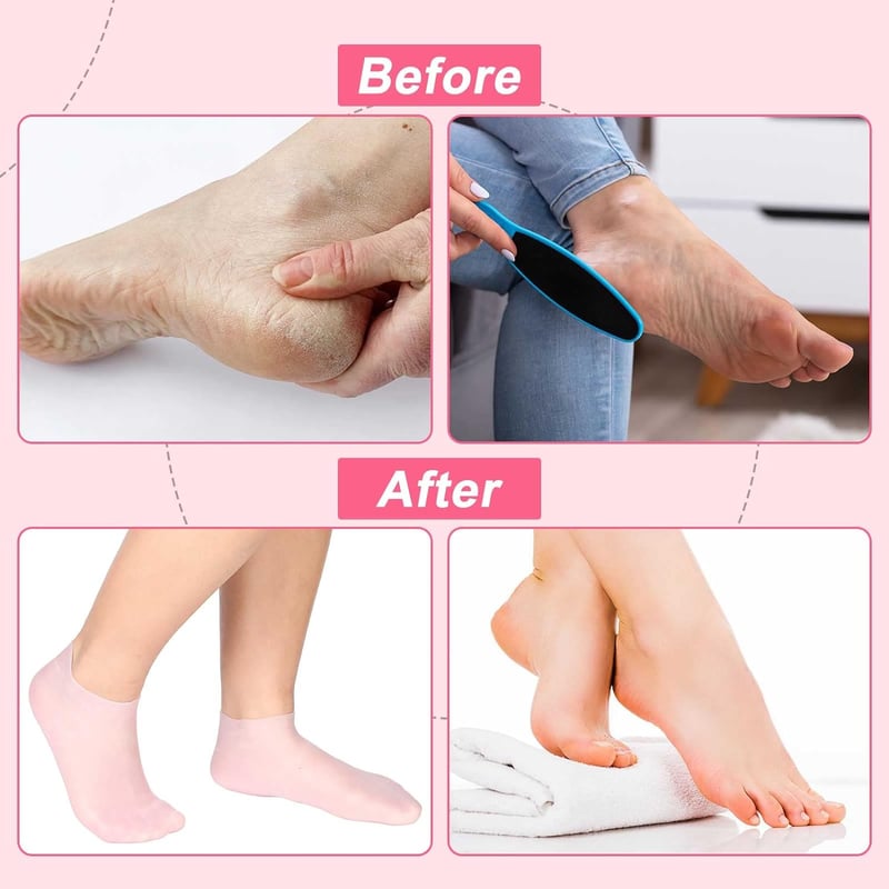SoftStep™ Silicone Spa Socks | BOGO Offer