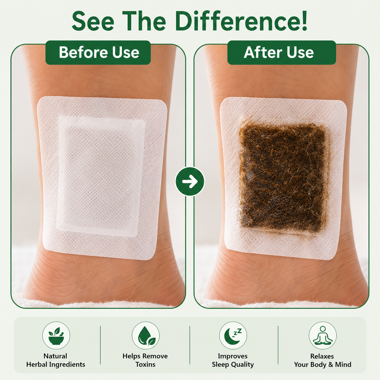 Mild Care Herbal Foot Pads | BUY 1 GET 1 FREE |
